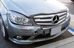 mercedes before collision repair